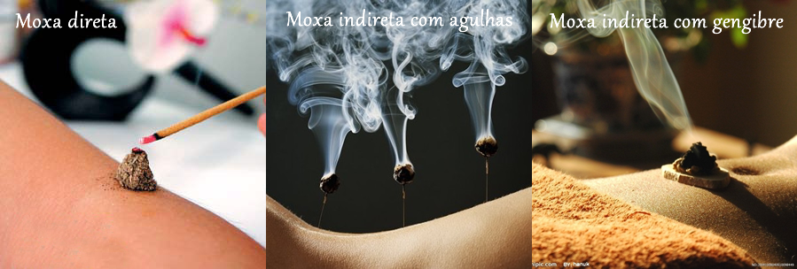 Tecnicas 2bde 2bmoxa.png