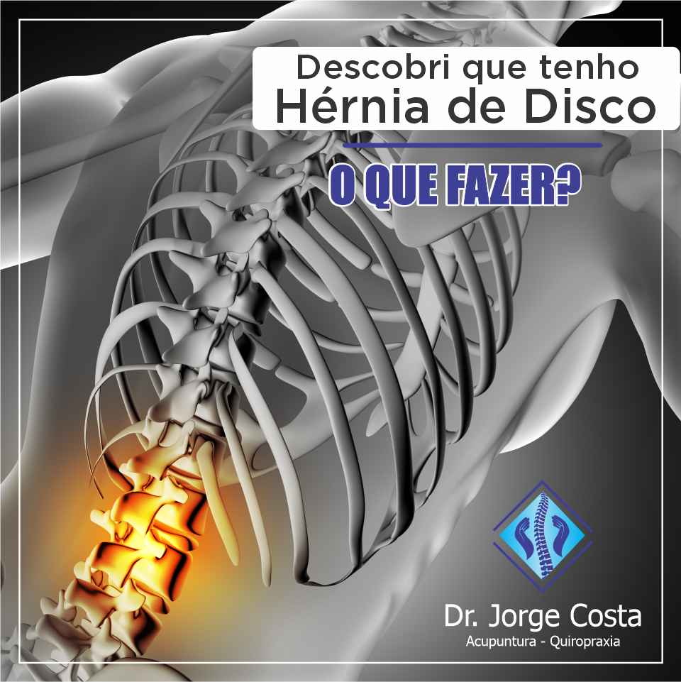 Hernia De Disco