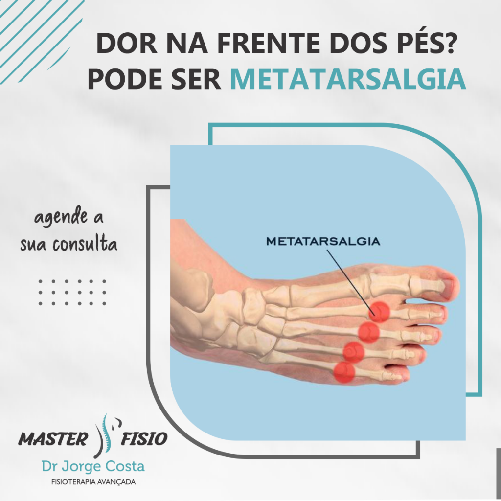 Metatarsalgia