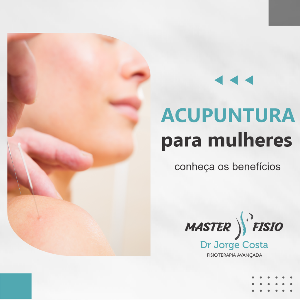 Acupuntura Para Mulheres